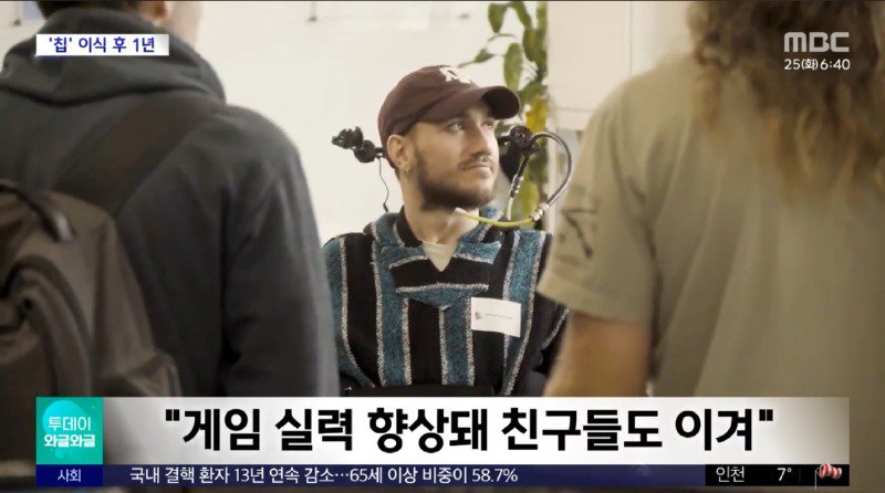 뇌에 뉴럴링크 칩을 박은 전신마비 환자 근황2
