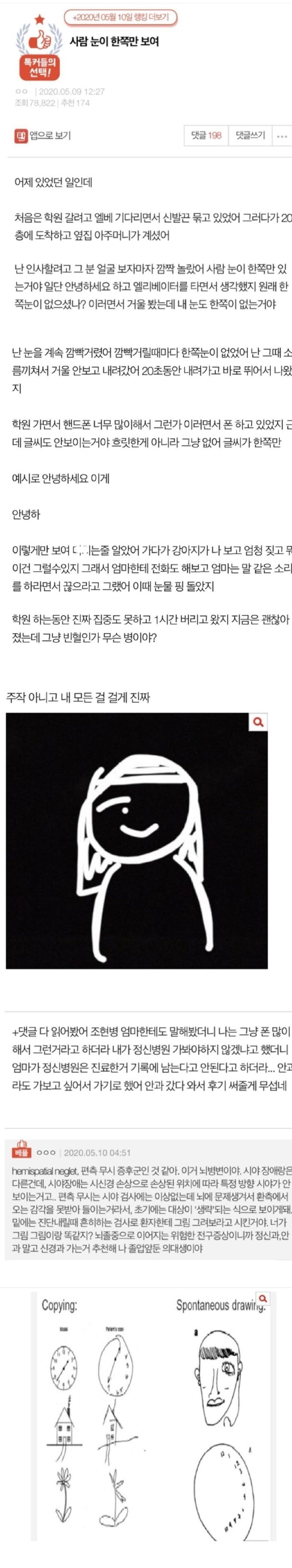 사람 눈이 한쪽만 보여.jpg1