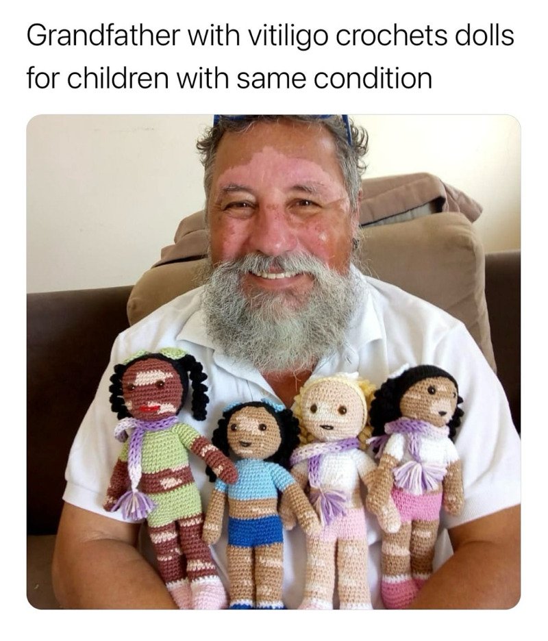 백반증 할아버지의 인형만들기 취미1
