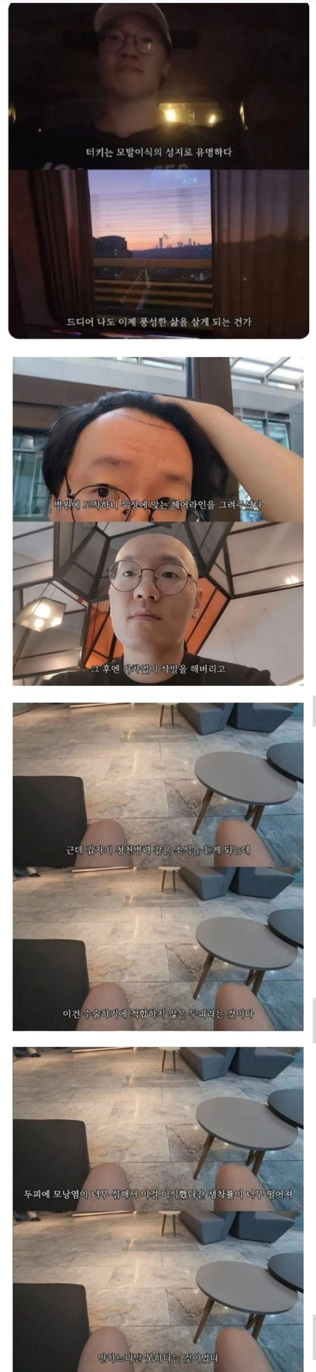 터키로 모발이식 받으러간 남성1