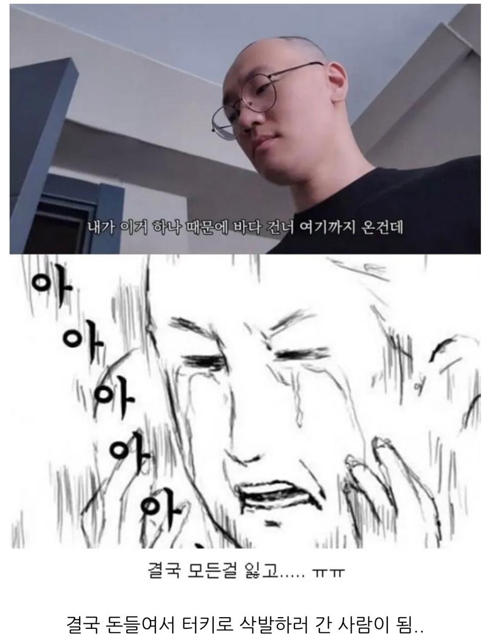 터키로 모발이식 받으러간 남성3