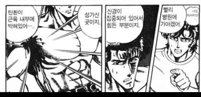 총맞았을때 외과적수술없이 셀프제거 방법2