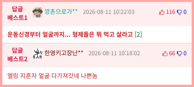 유전자 몰빵의 피해자.jpg2