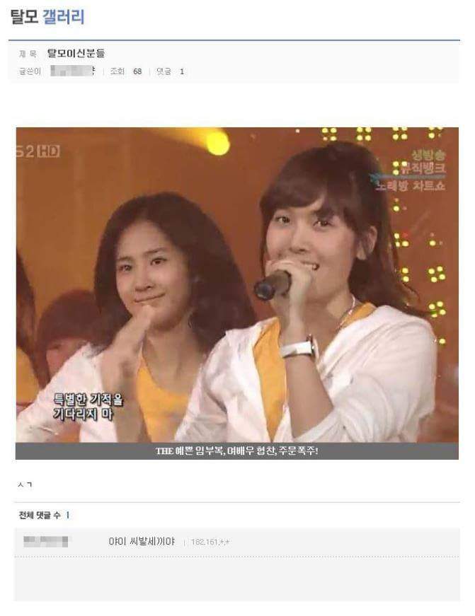 탈모인 극도발 모음.jpg4