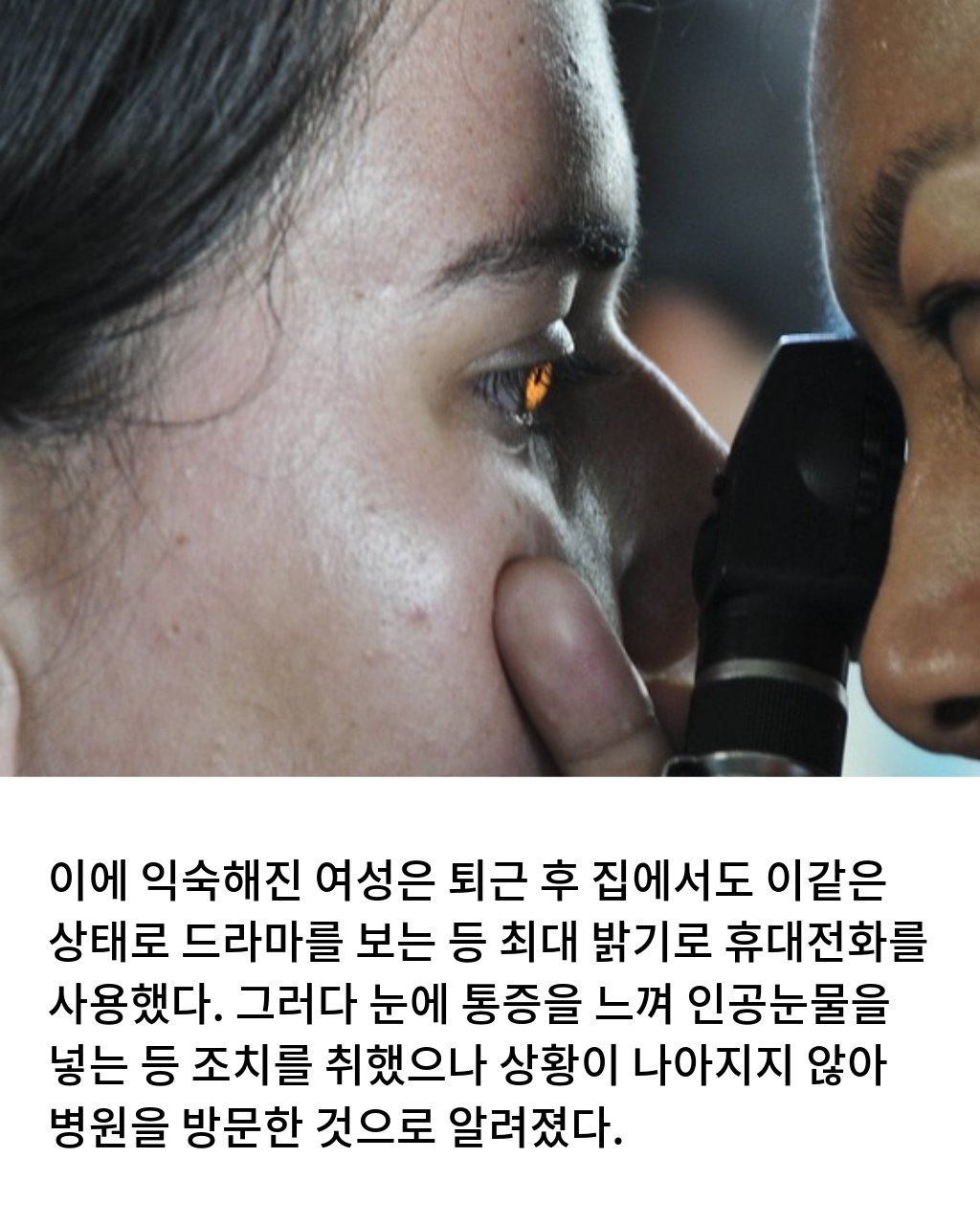 스마트폰 최대 밝기로 보다가 각막에 구멍남4